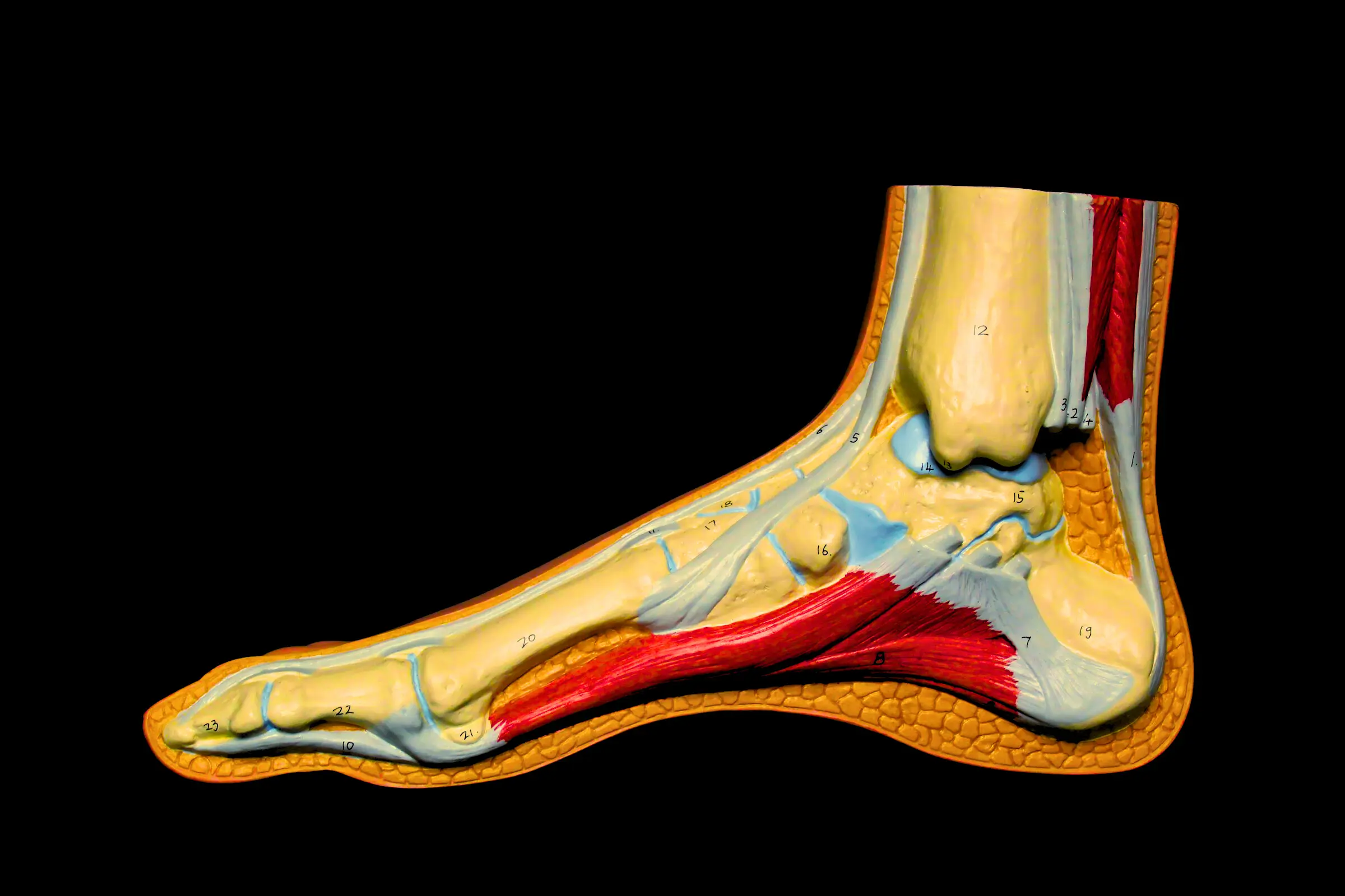 Don't Ruin Your Race! Fix a Sore Achilles While Running